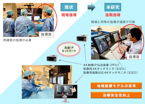 血管内治療