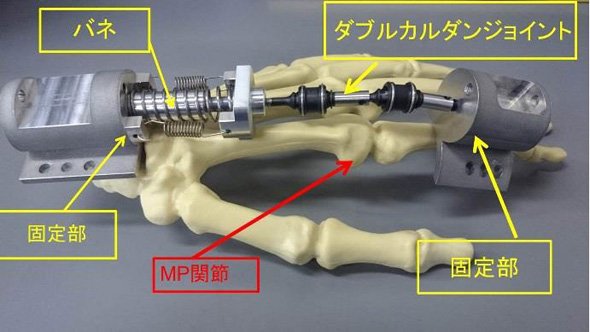 開発したMP関節部の創外固定器