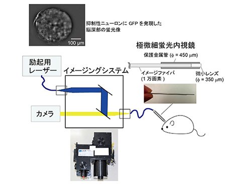 U-FEISの概略図と先端部形状
