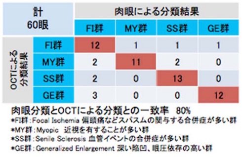 肉眼分類とOCTによる分類の比較